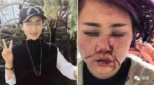 云南丽江“女子遭暴打”景区毁了我婚姻